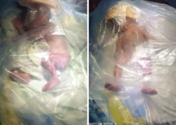 Heboh ; Kurangnya Sapras Puskesmas, Seorang Bayi Baru Lahir Meningal Terbungkus Plastik di Midai