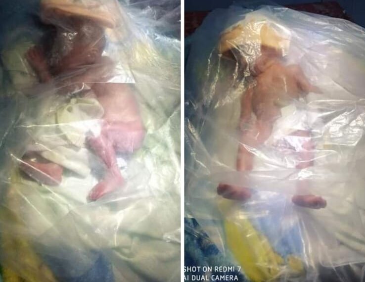 Heboh ; Kurangnya Sapras Puskesmas, Seorang Bayi Baru Lahir Meningal Terbungkus Plastik di Midai