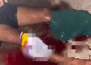 Diterkam Buaya Saat Hendak Melaut, Nelayan di Bintan Alami Luka Serius di Kedua Kaki