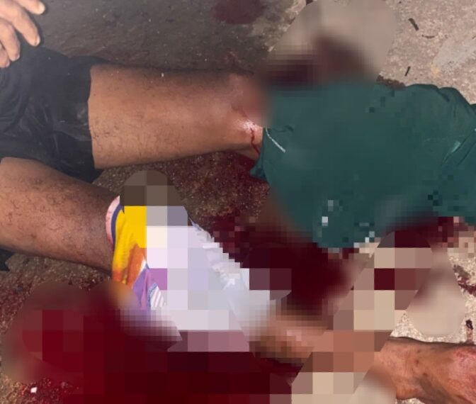 Diterkam Buaya Saat Hendak Melaut, Nelayan di Bintan Alami Luka Serius di Kedua Kaki